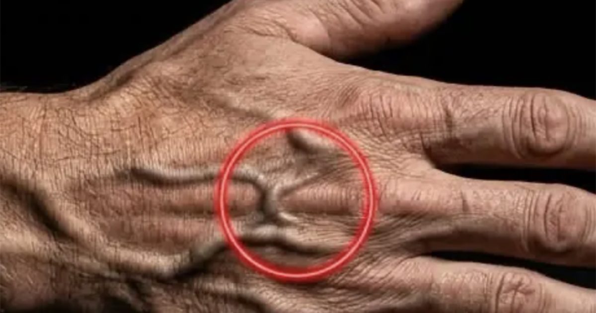 Si vos veines sont visibles, cela signifie ceci