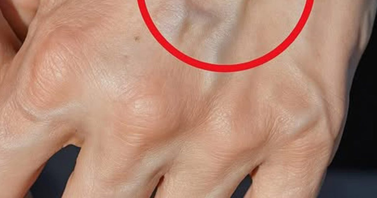 Si vos veines sont visibles, en voici la signification