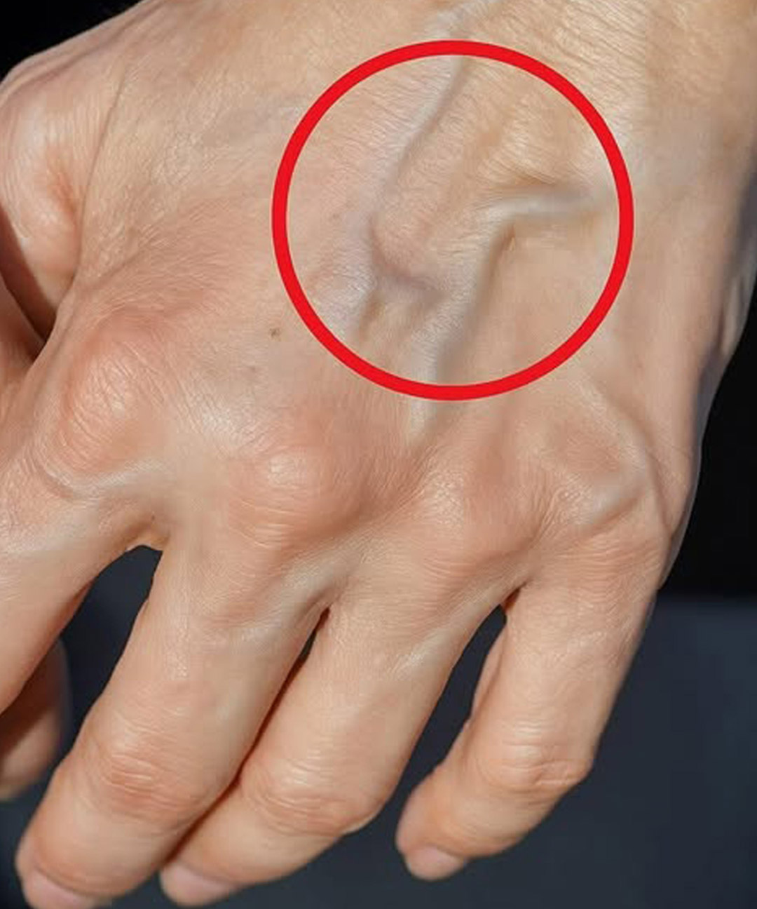 Si vos veines sont visibles, en voici la signification