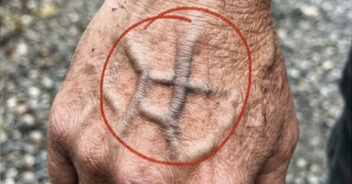 Si vos veines sont visibles, en voici la signification
