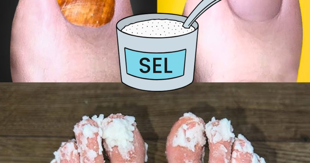 Si vous avez une mycose des ongles, essayez ce remède naturel