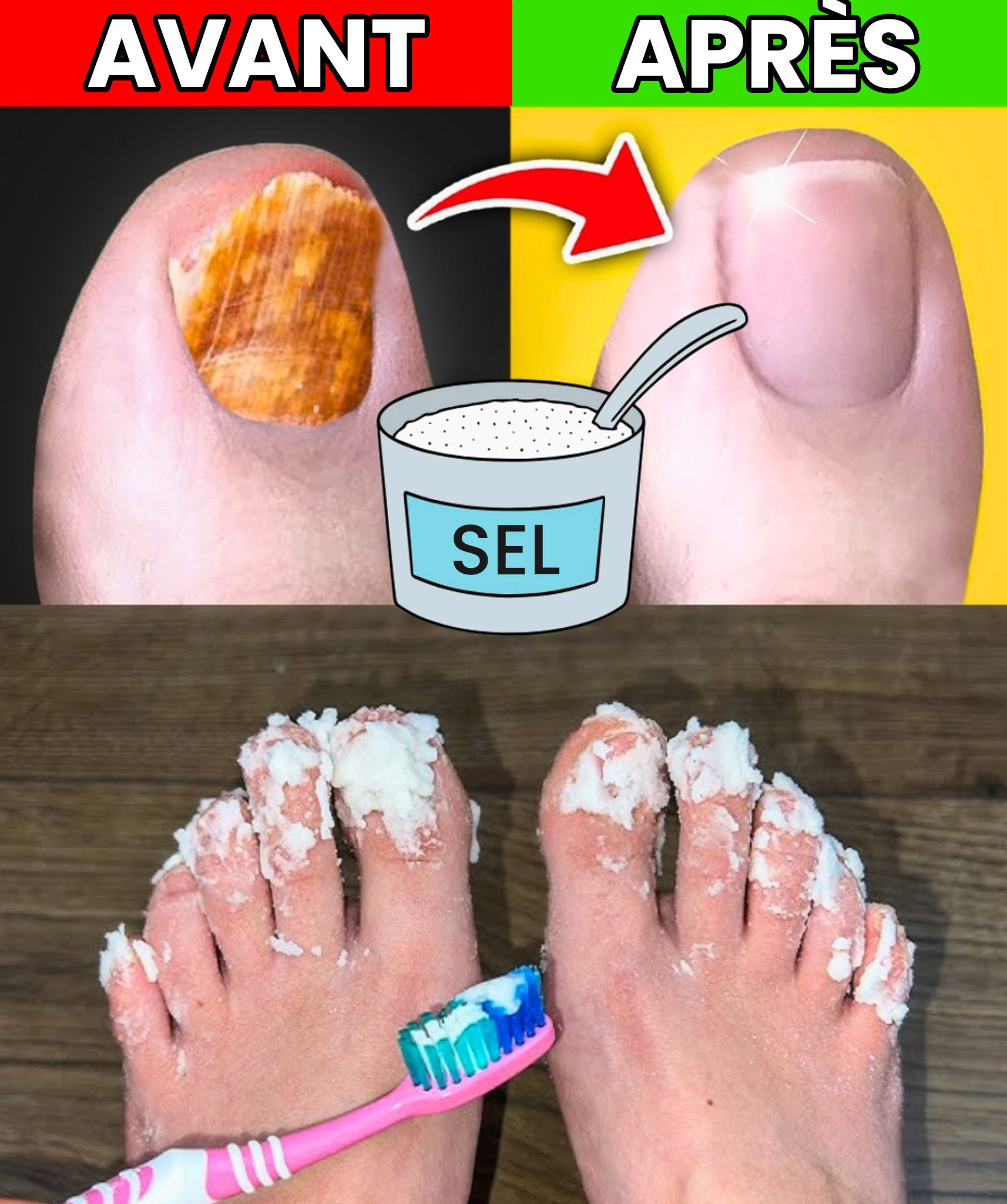Si vous avez une mycose des ongles, essayez ce remède naturel