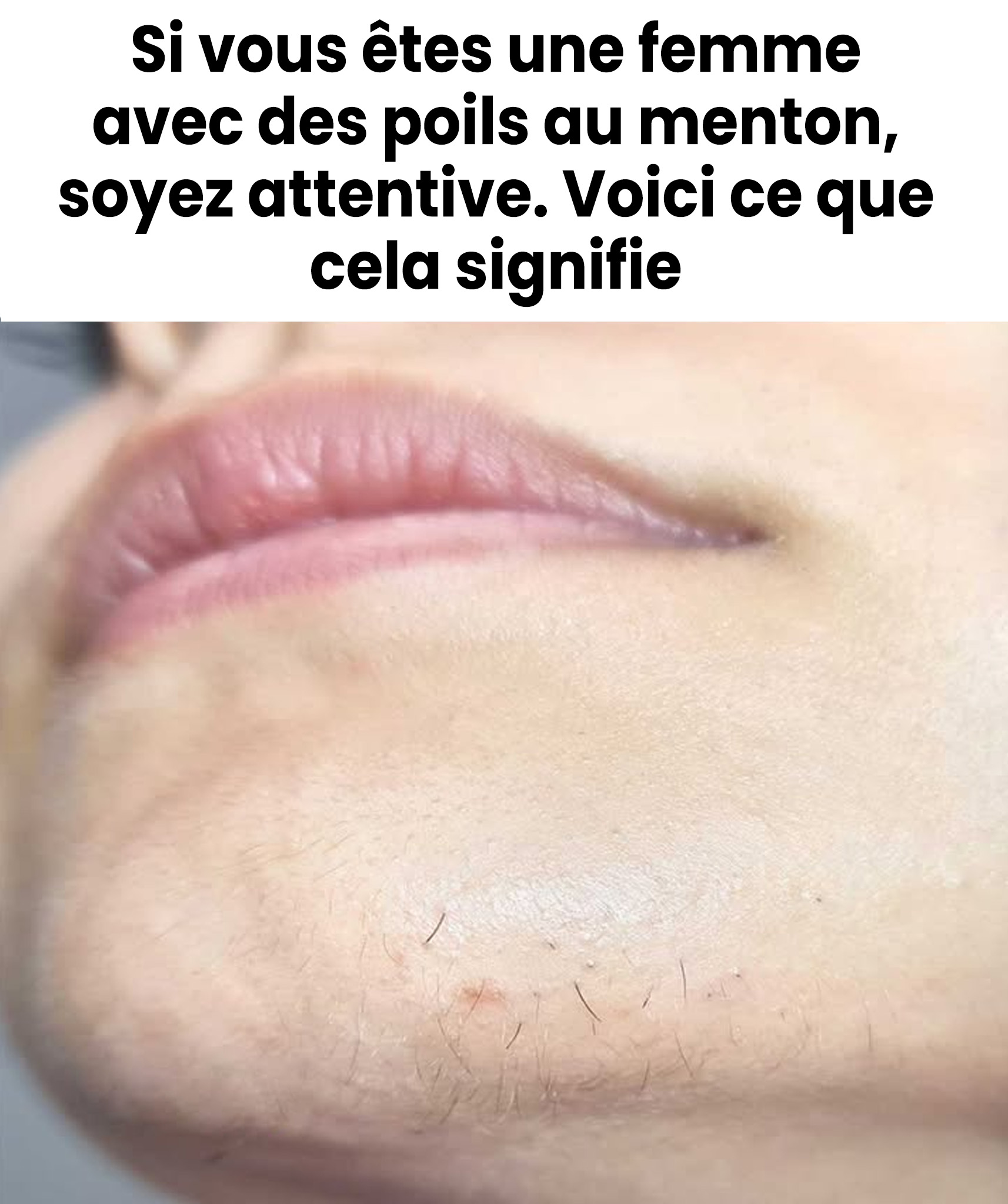 Si vous êtes une femme avec des poils au menton, soyez attentive. Voici ce que cela signifie
