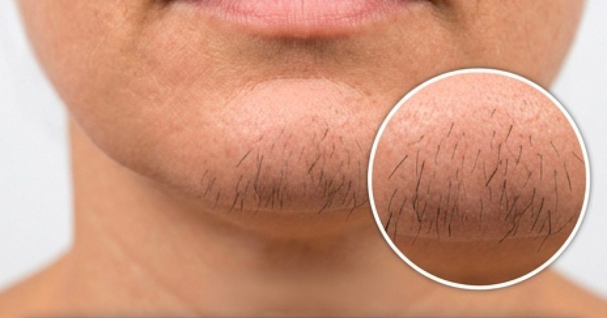 Si vous êtes une femme avec des poils au menton, voici ce que cela signifie vraiment
