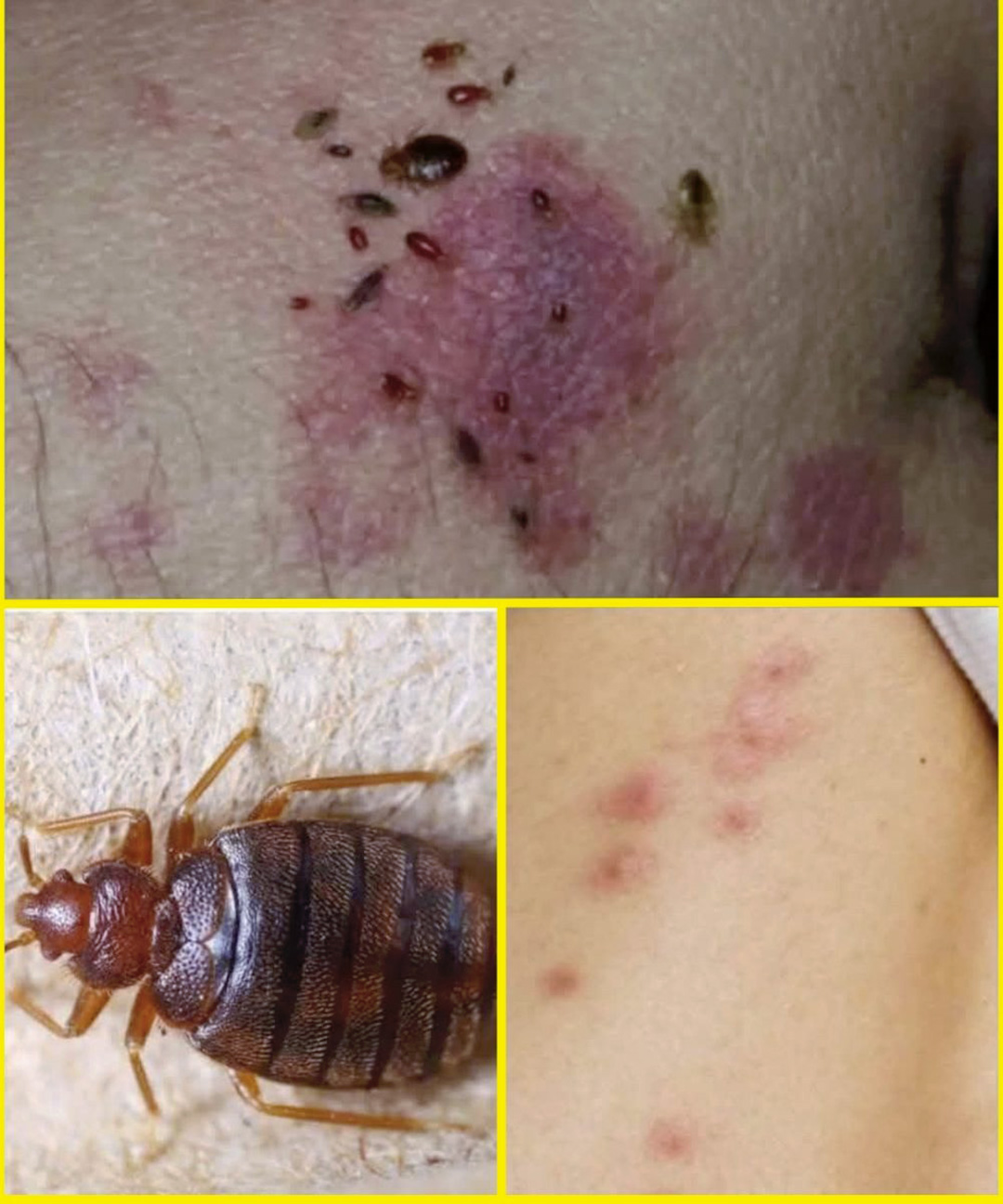 Si vous remarquez ces marques sur votre peau, en voici la signification