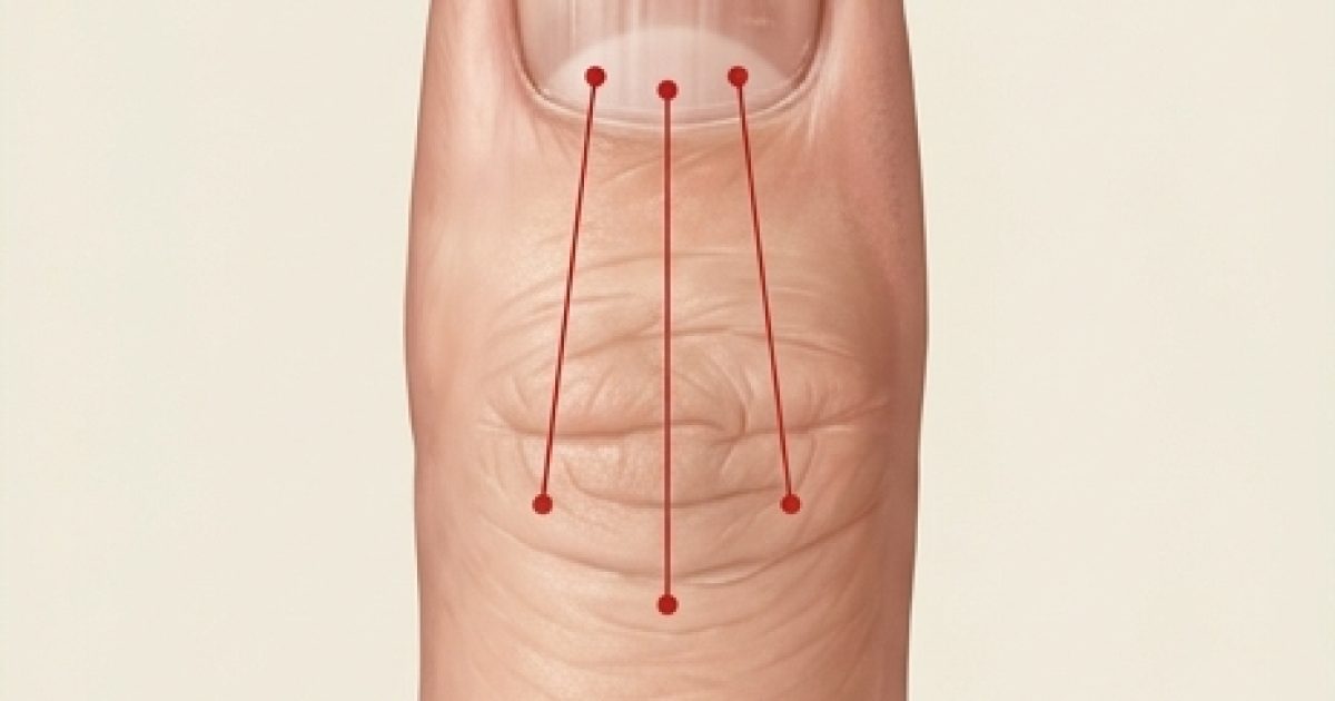 Si vous remarquez des stries sur vos ongles, cela pourrait indiquer que vous souffrez de ceci