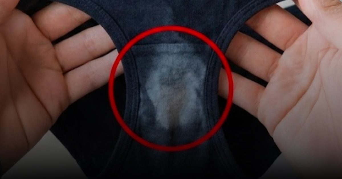 Si vous trouvez une tache « décolorée » sur vos sous-vêtements, voici ce que cela signifie