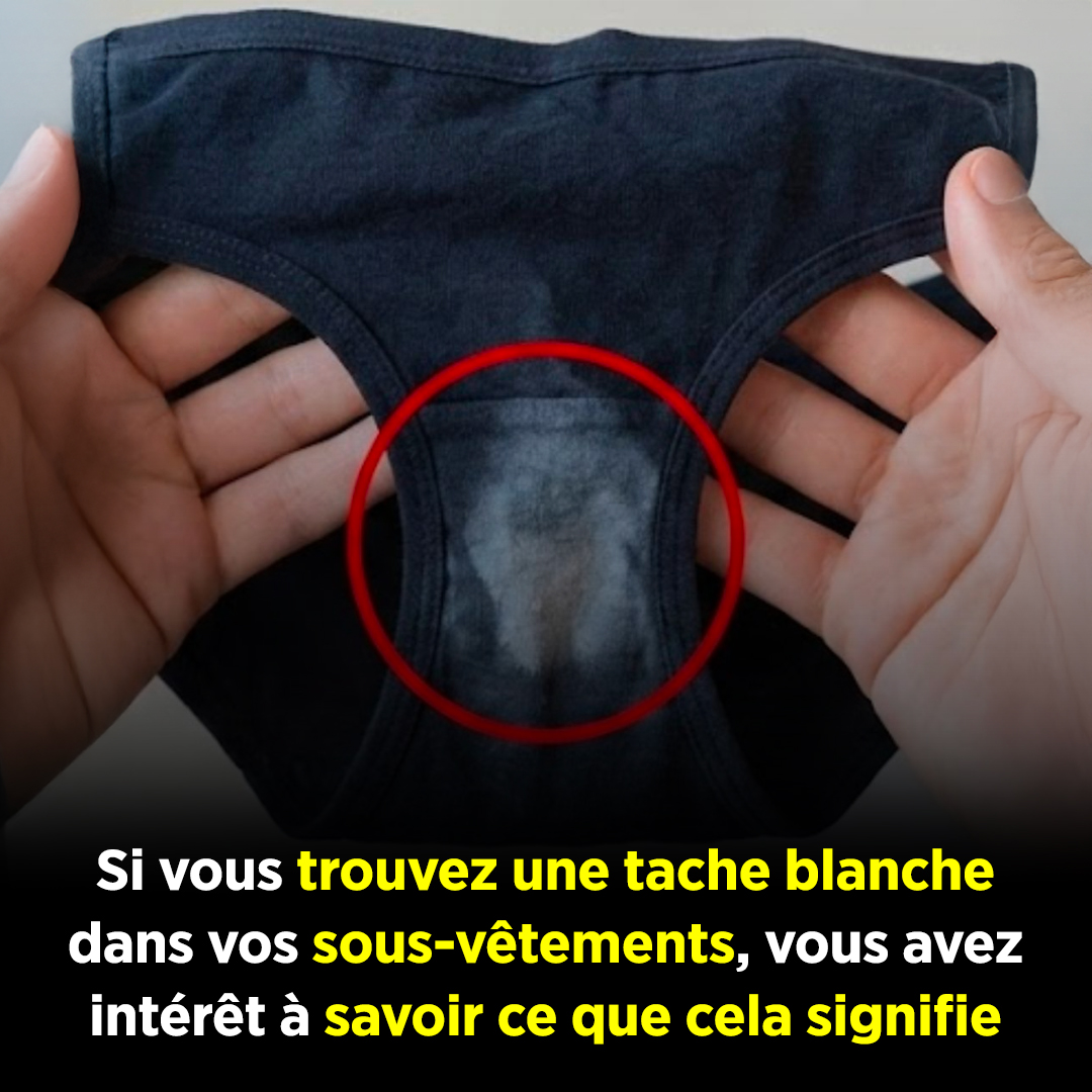 Si vous trouvez une tache « décolorée » sur vos sous-vêtements, voici ce que cela signifie