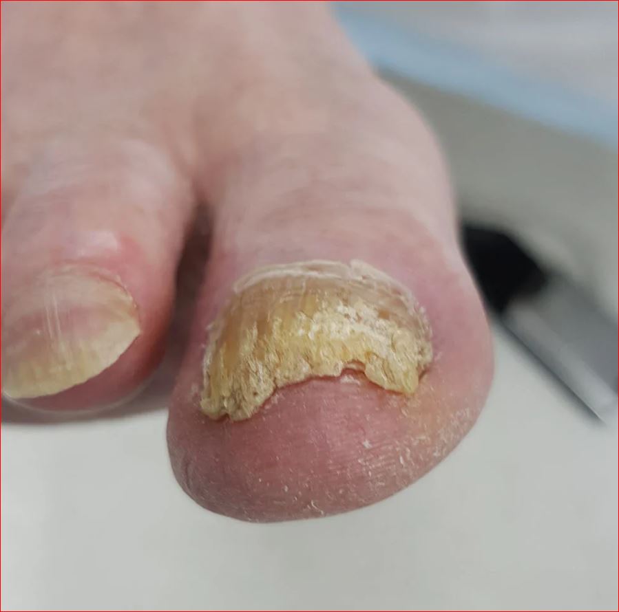 L’astuce transmise par ma grand-mère pour affiner les ongles épais, testée et approuvée