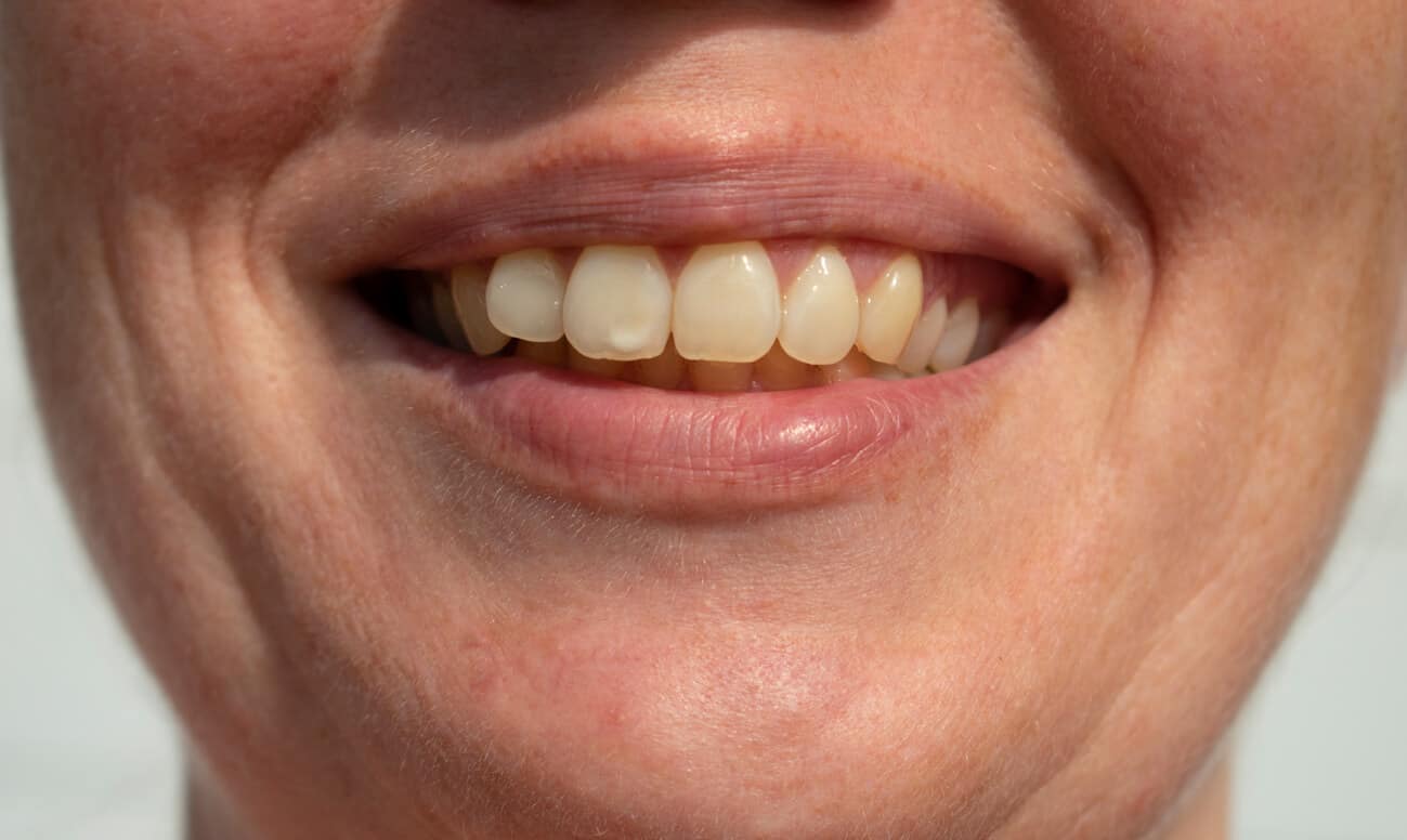 Femme souriante montrant ses dents