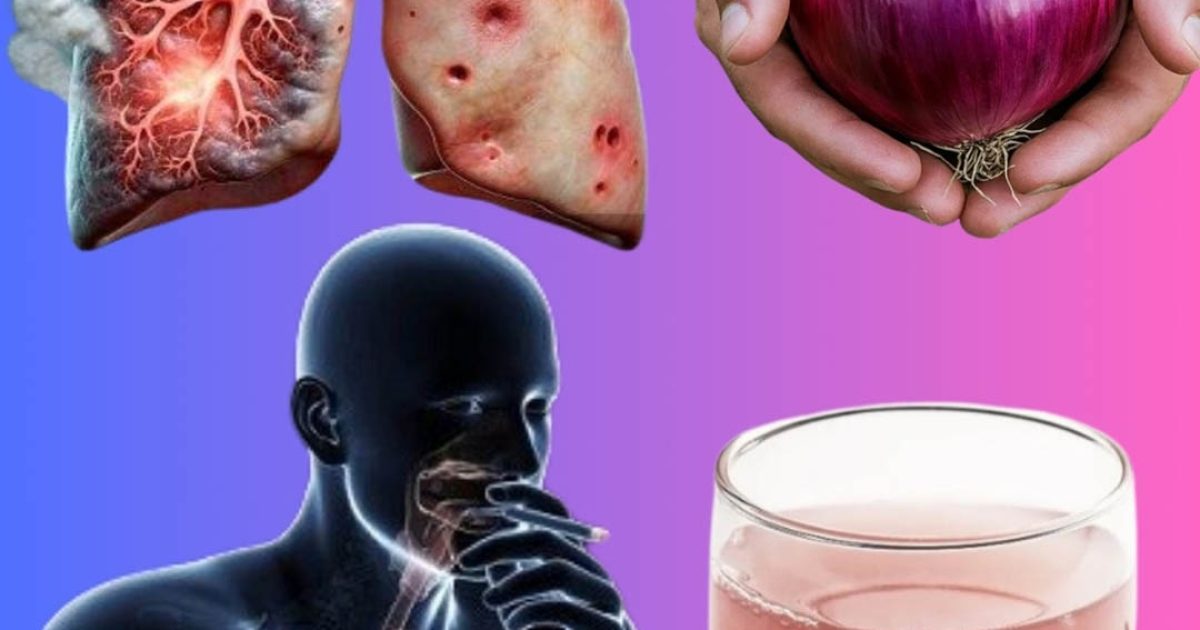 Toux persistante, mucosités ou congestion pulmonaire ? Essayez ce remède naturel à l'oignon