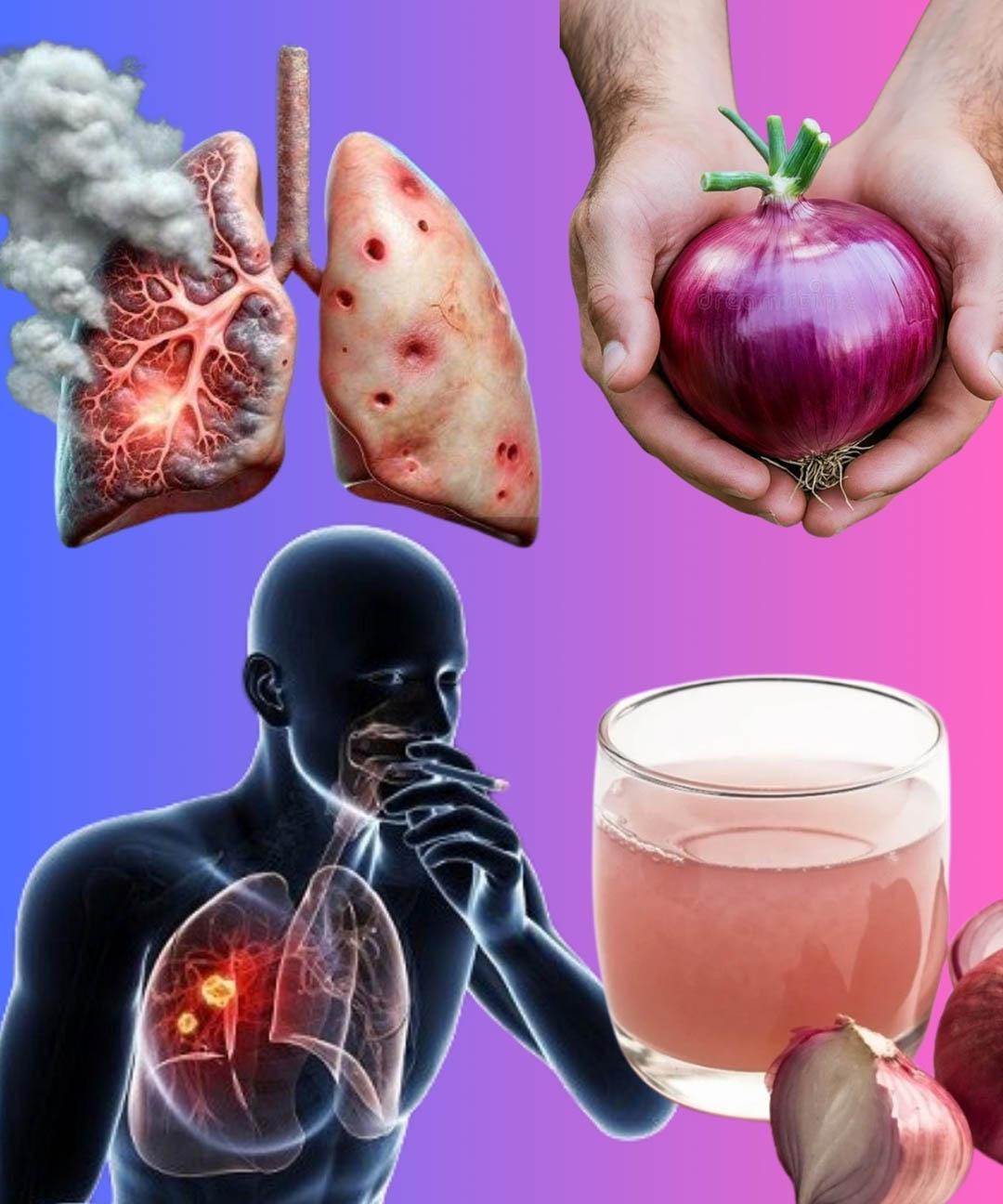 Toux persistante, mucosités ou congestion pulmonaire ? Essayez ce remède naturel à l'oignon
