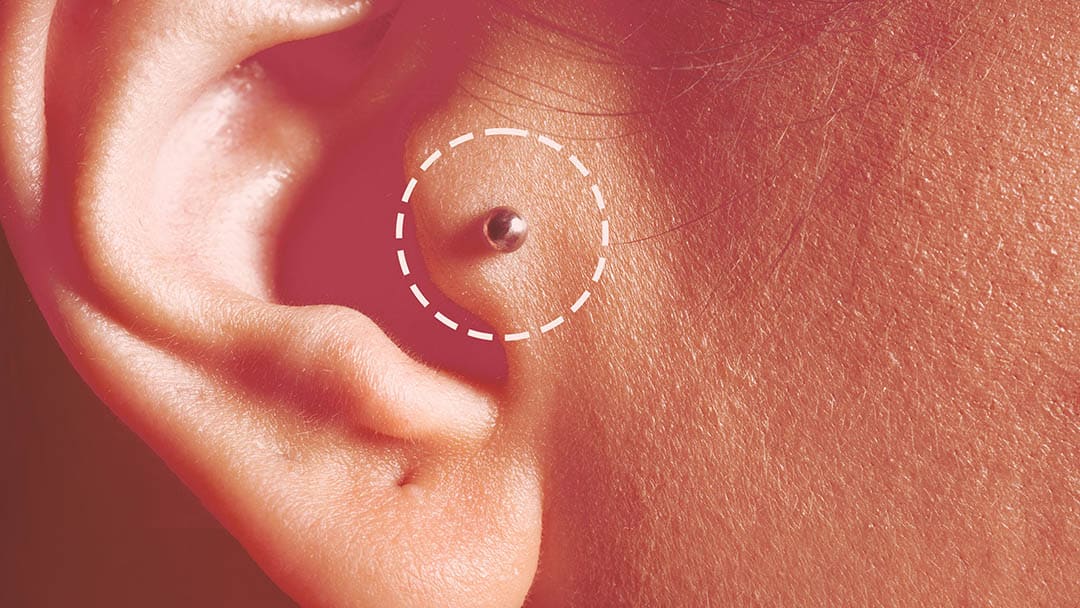 Piercing de tragus, détail esthétique