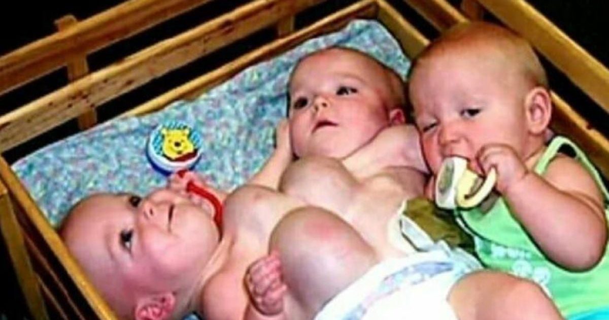 Trois sœurs sont nées triplées, dont deux siamoises… mais elles ont été abandonnées dès leur naissance