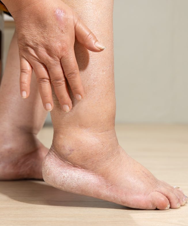 La vérité surprenante sur ce qui arrive à vos pieds quand vous portez des chaussures trop longtemps