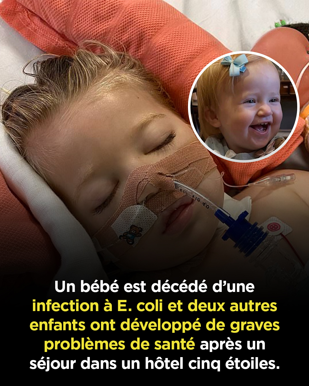 Un bébé décède d’une infection à E. coli et deux autres enfants souffrent de graves problèmes de santé après un séjour dans un hôtel cinq étoiles en Égypte