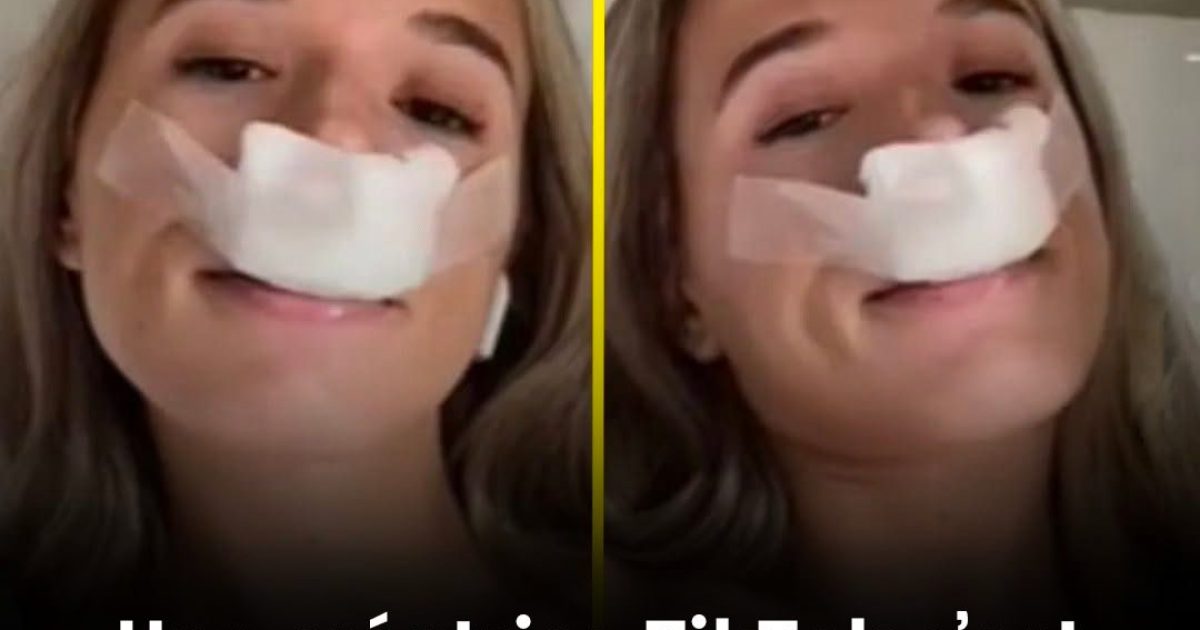 Un créateur TikTok s’est fait faire une rhinoplastie dans l’idée que ses futurs enfants n’héritent pas de son « nez moche »