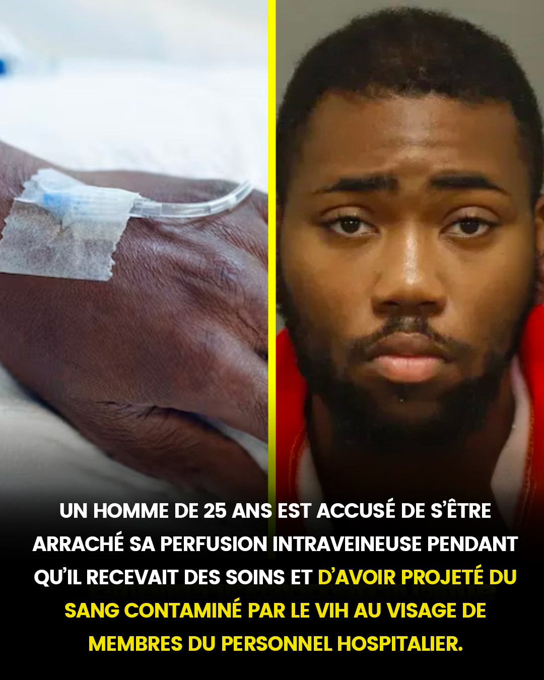 Un homme de 25 ans est accusé d’avoir arraché sa perfusion intraveineuse pendant un traitement et d’avoir jeté du sang contaminé par le VIH au visage du personnel hospitalier