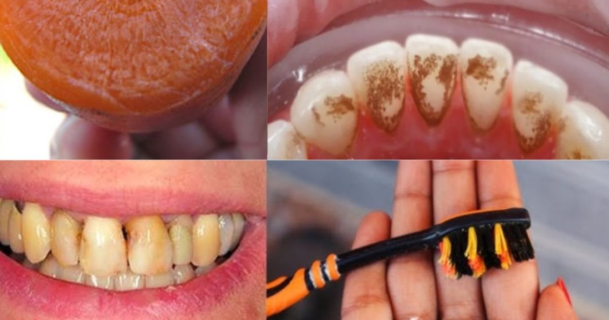 Un sourire éclatant grâce aux fanes de carottes ? L’astuce naturelle qui se cache dans votre cuisine