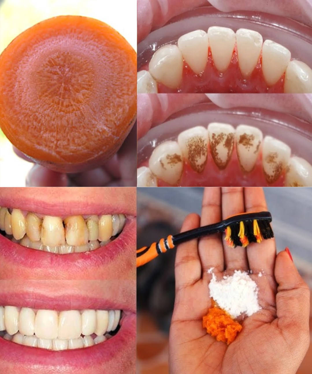 Un sourire éclatant grâce aux fanes de carottes ? L’astuce naturelle qui se cache dans votre cuisine