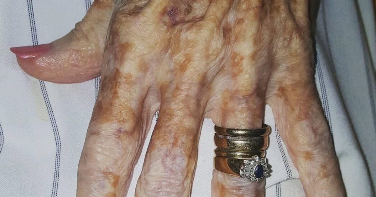 Une infirmière photographie la main d’une vieille dame, puis remarque un détail sur l’image qui enflamme Internet