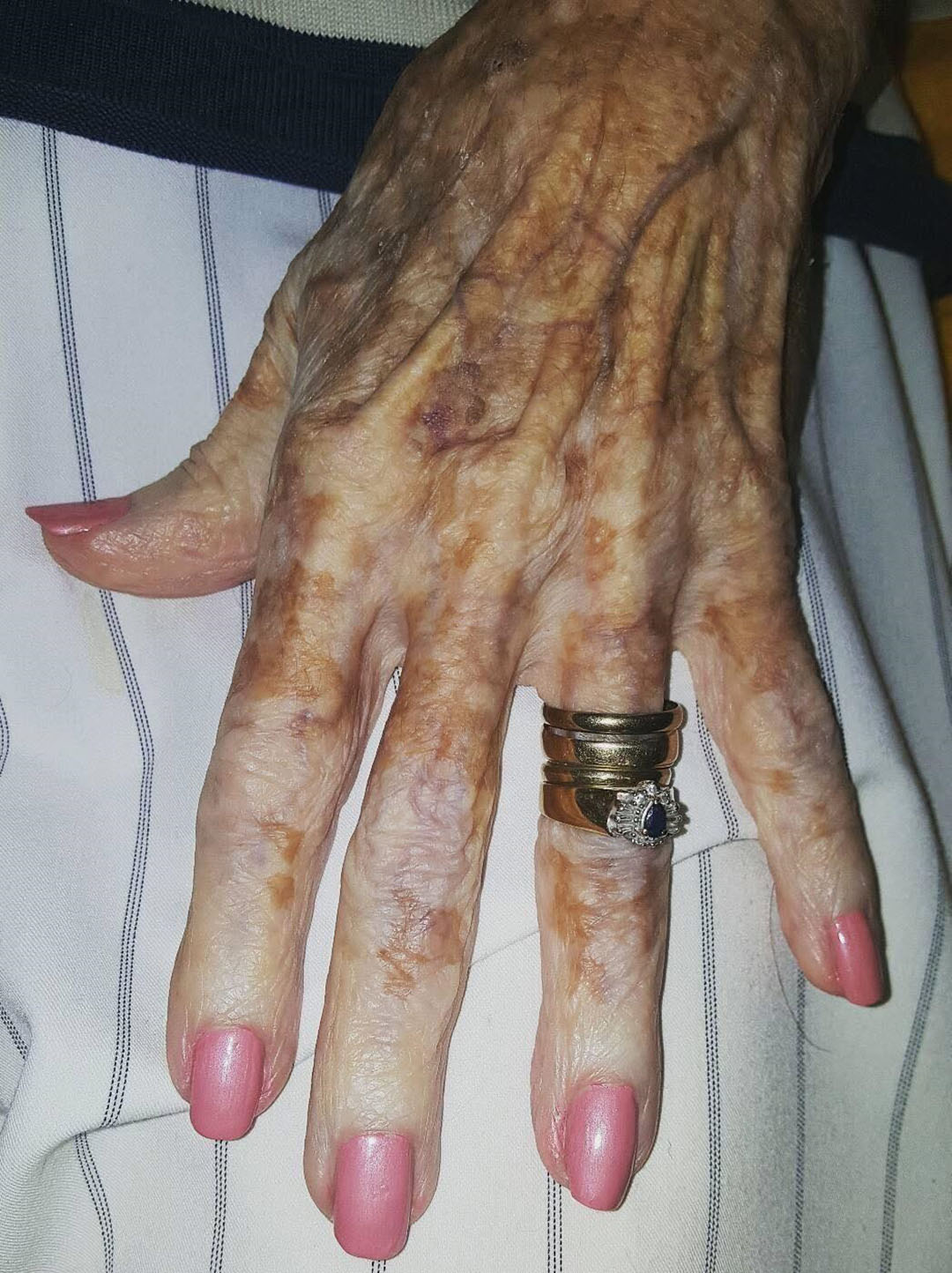 Une infirmière photographie la main d’une vieille dame, puis remarque un détail sur l’image qui enflamme Internet
