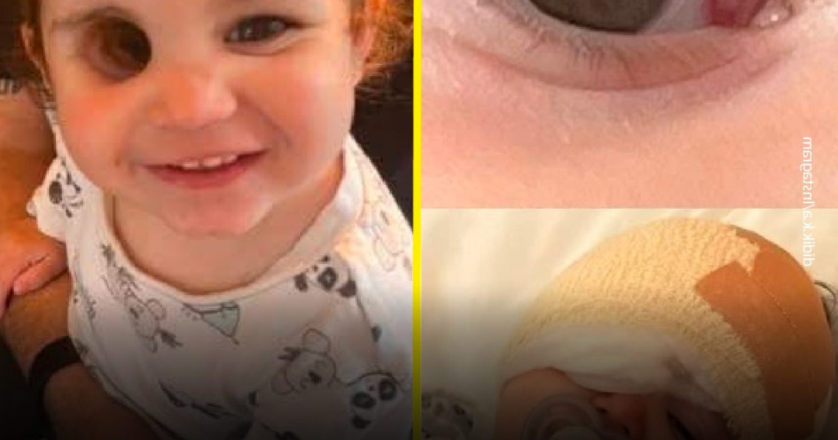 Une petite fille est née avec un cancer de l’œil agressif qui a nécessité l’ablation de son œil, et sa guérison a ému le cœur de beaucoup