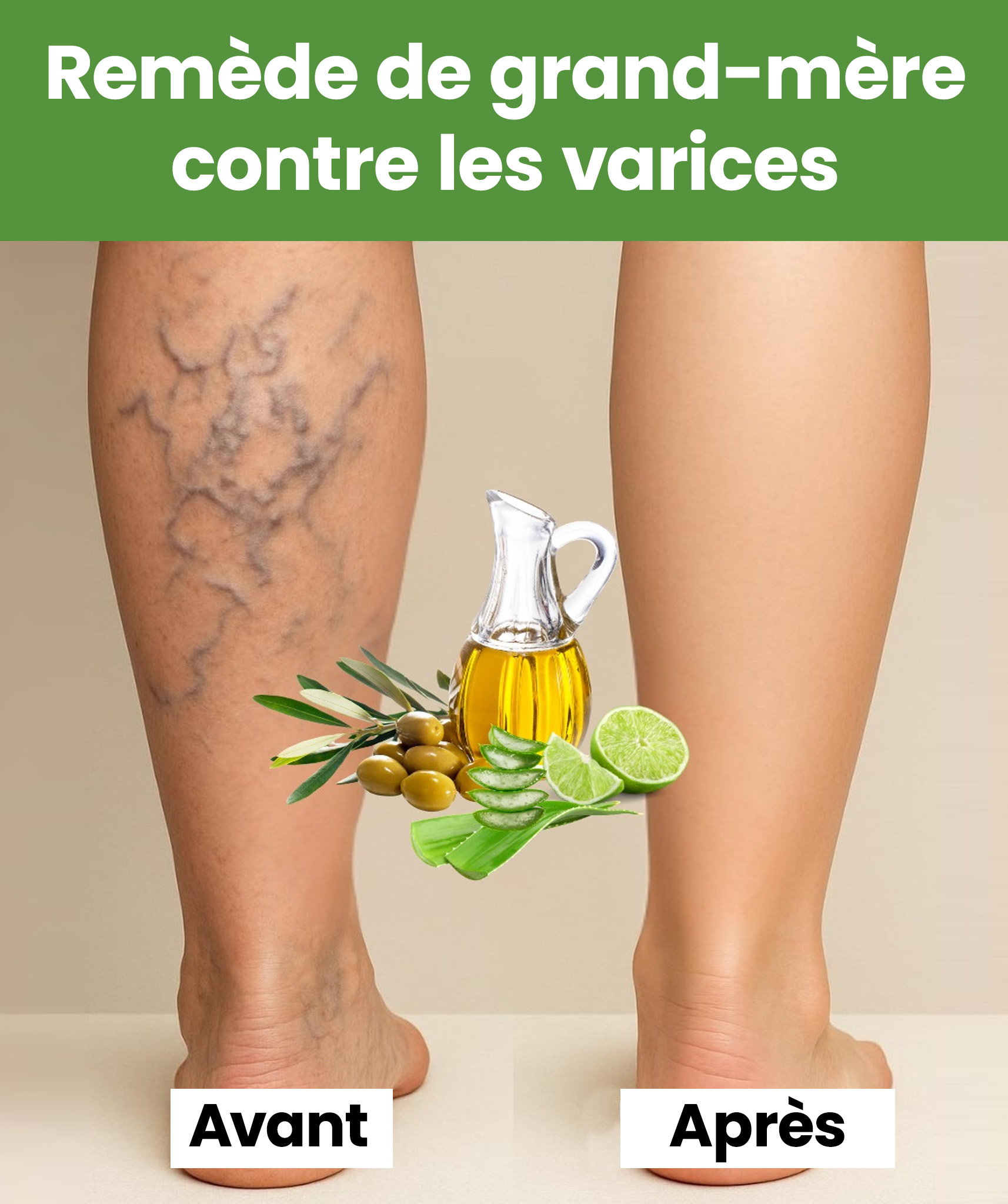 Varices : le remède de grand-mère 100 % naturel avec aloe vera, vinaigre et citron