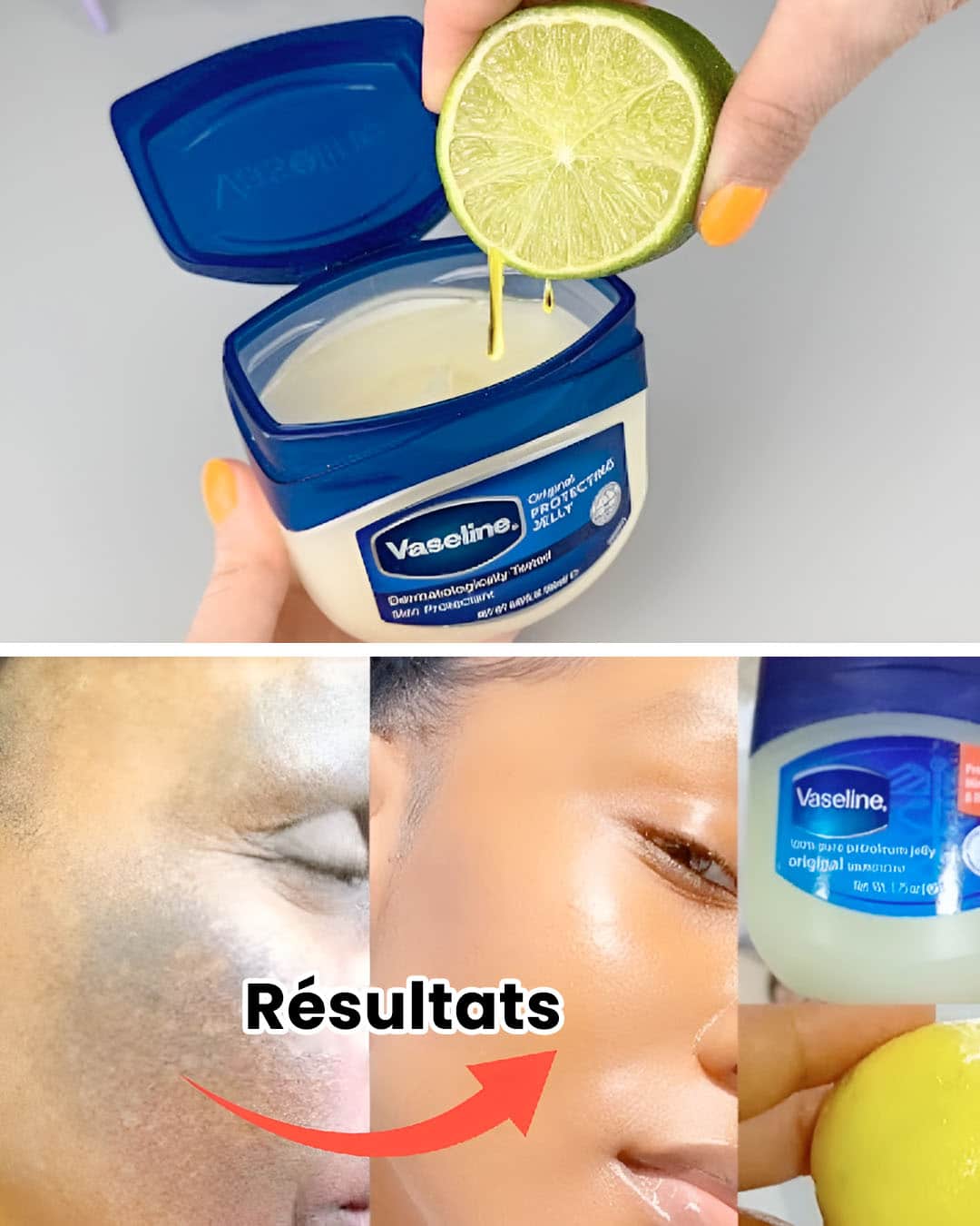 Vaseline et citron : le secret maison pour une peau douce, lisse et éclatante