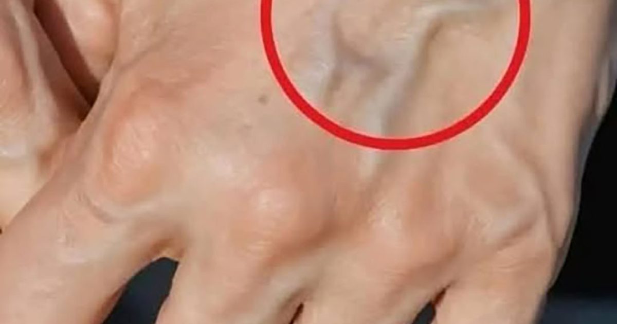 Veines visibles : que signifient-elles ?