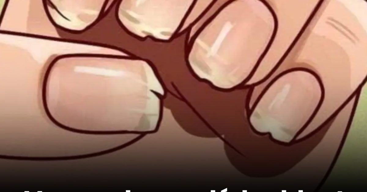 Voici 9 choses que vos ongles disent sur votre santé