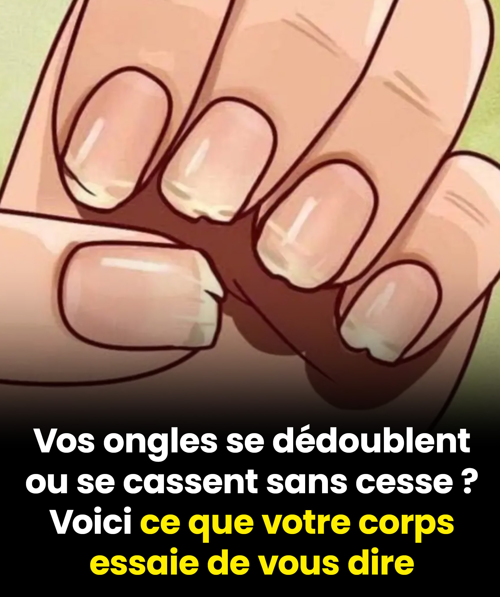 Voici 9 choses que vos ongles disent sur votre santé