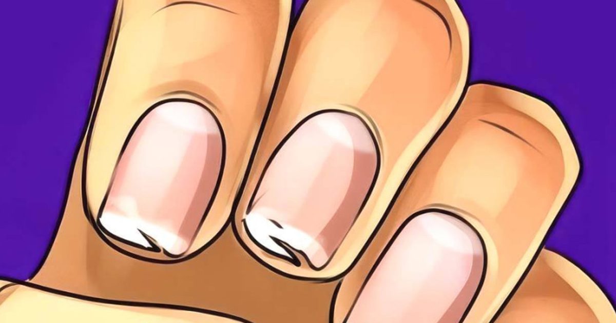 Vos ongles sont fragiles, se fissurent ou se dédoublent régulièrement ? Ce n’est pas anodin : votre corps vous envoi un message