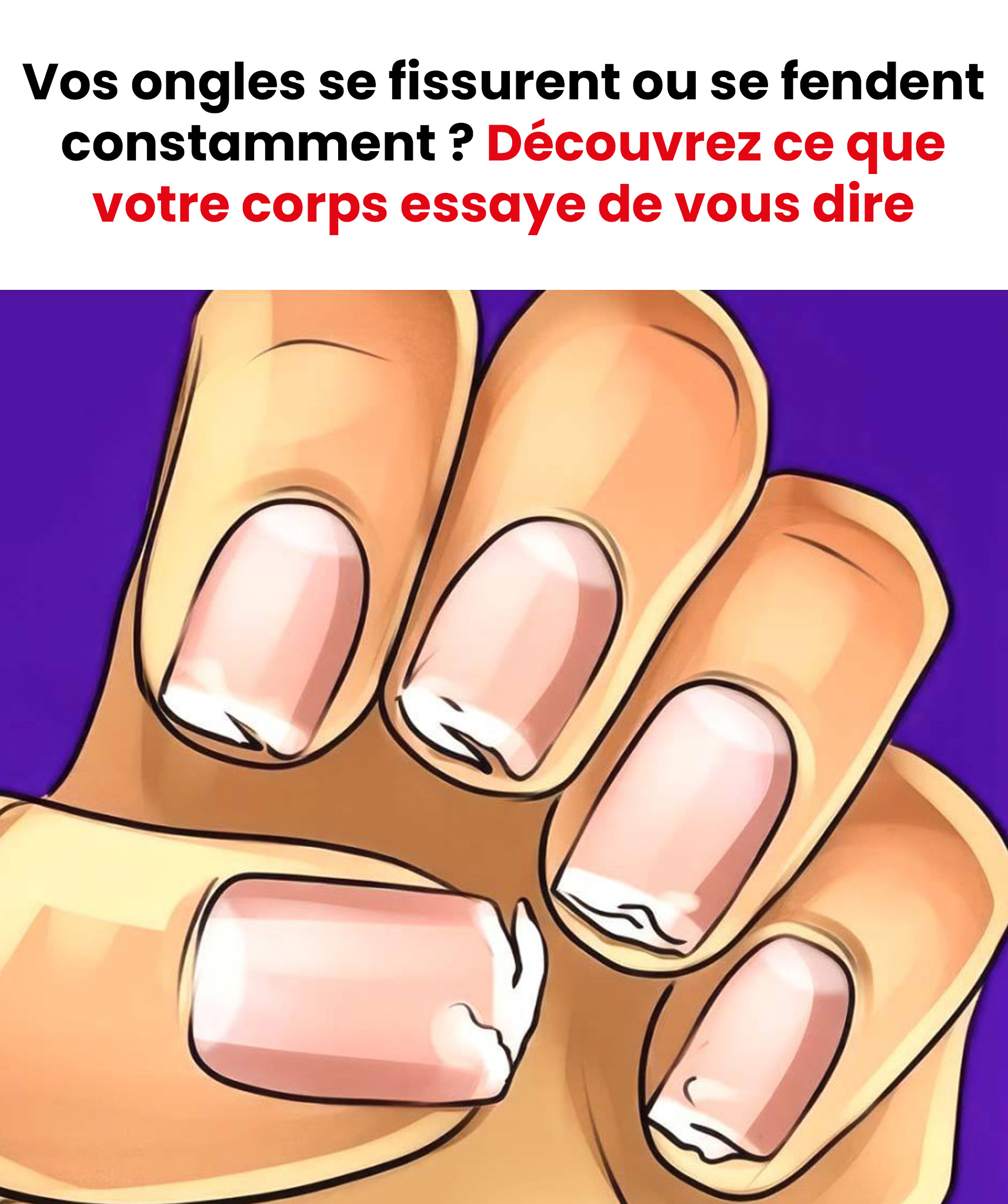 Vos ongles sont fragiles, se fissurent ou se dédoublent régulièrement ? Ce n’est pas anodin : votre corps vous envoi un message