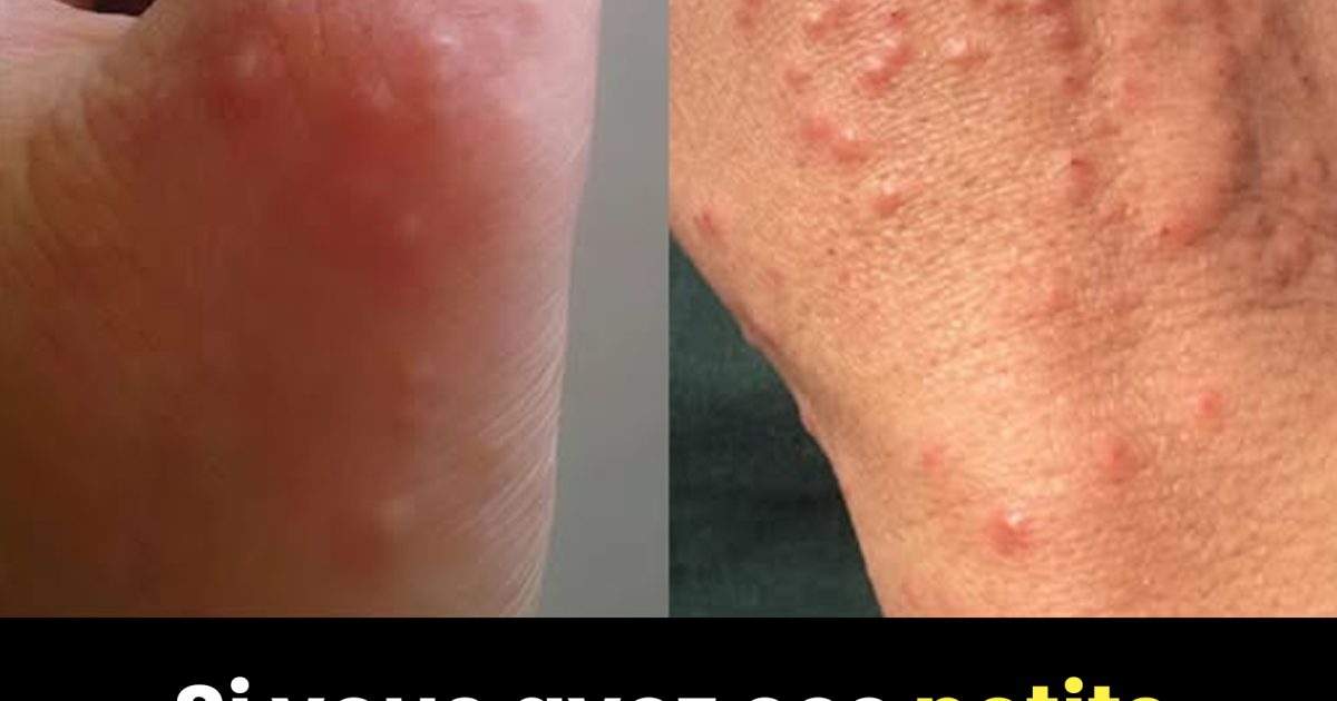 Vous avez ces petites taches rouges sur votre bras ? Voici ce qu’elles signifient