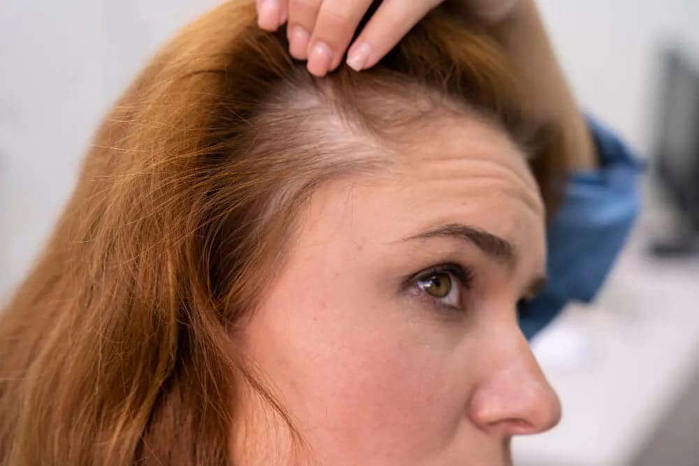 Femme se protégeant le cuir chevelu du soleil