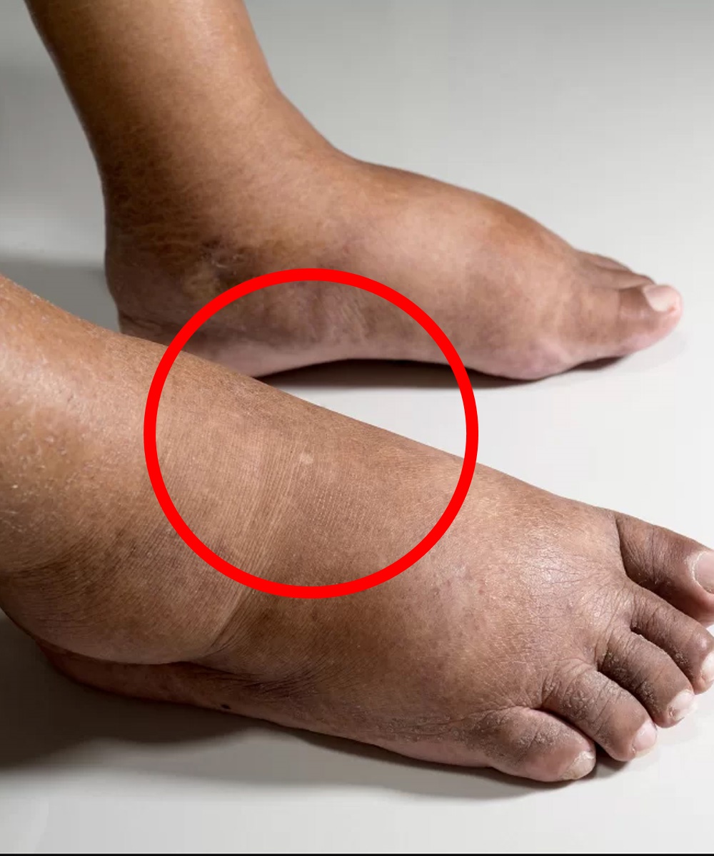 La vérité surprenante sur ce qui arrive à vos pieds quand vous portez des chaussures trop longtemps